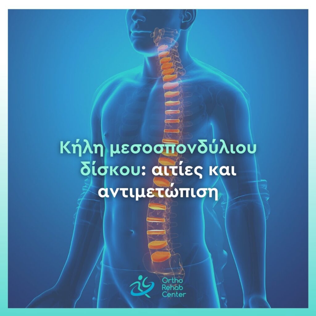 Κήλη μεσοσπονδύλιου cover