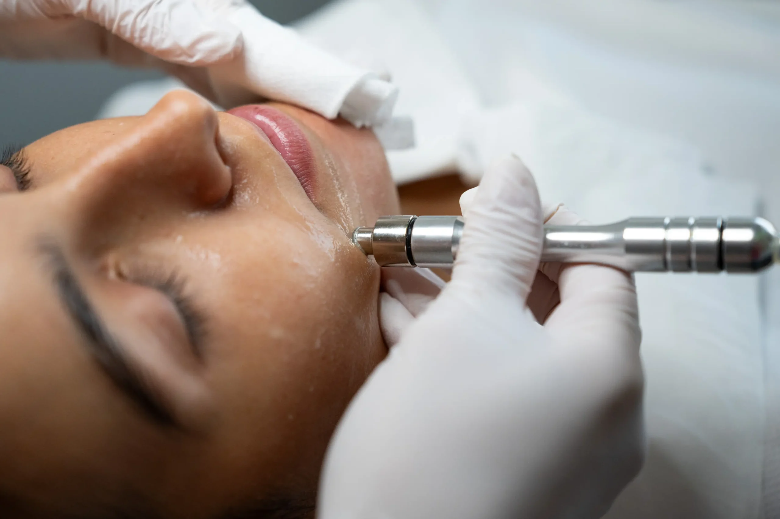 θεραπεία προσώπου με μεταλλική συσκευή σε περιοχή του πηγουνιού