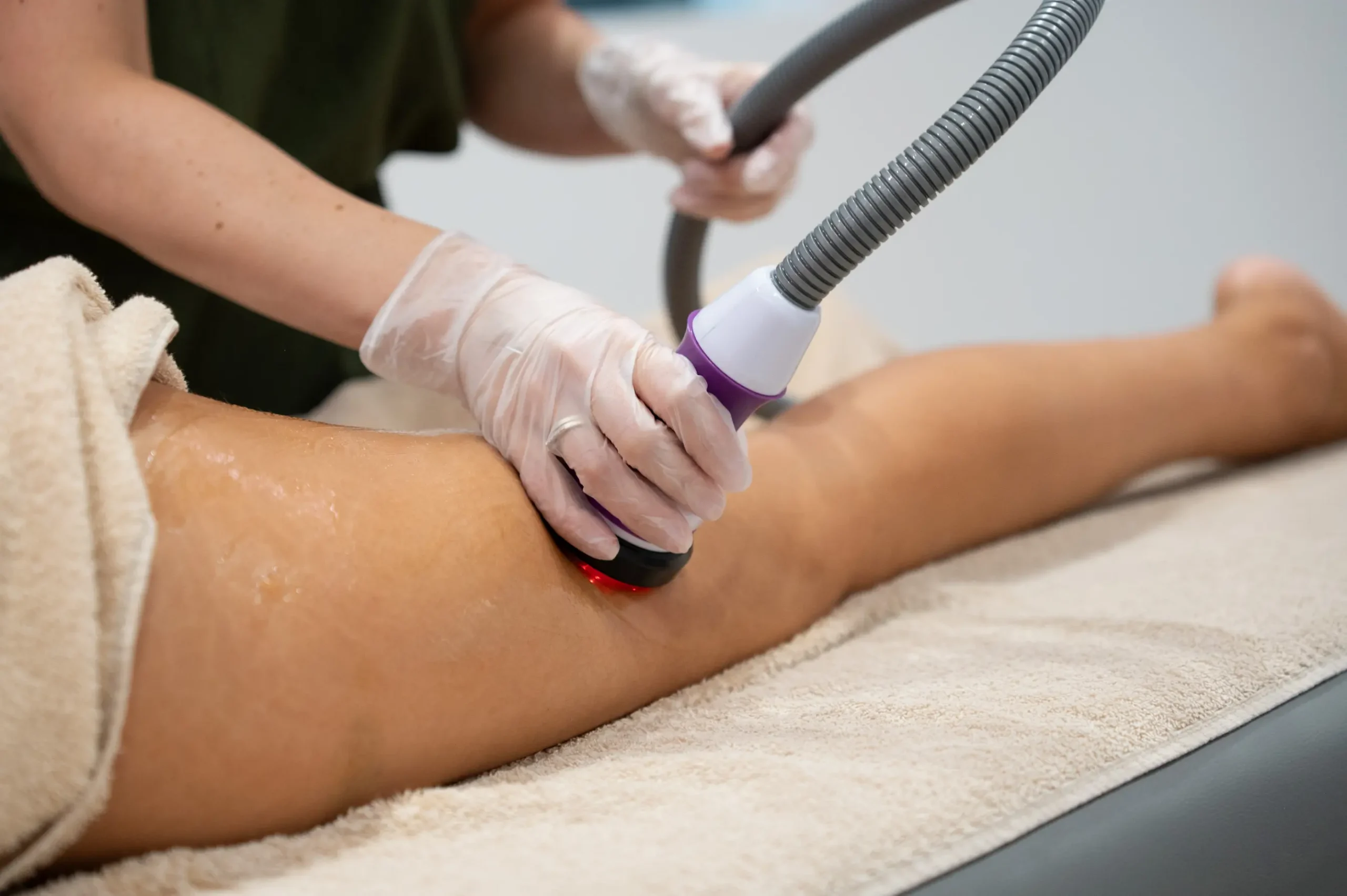 θεραπεία σώματος με συσκευή ραδιοσυχνοτήτων σε πόδι